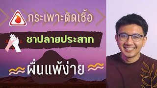 ติดเชื้อที่กระเพาะ | ชามือเท้า | ผื่นแพ้ง่าย - หมอนัท ตอบคำถาม