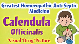 Calendula Officinalis Homoeopathic Mother Tincture Uses,Symptoms | Antiseptic for Cuts, Wound |