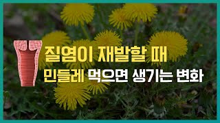 질염에 좋은 음식, 민들레의 효능과 잘 맞는 체질은?