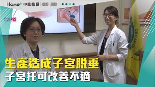 醫療新知|生產造成子宮脫垂 子宮托可改善不適