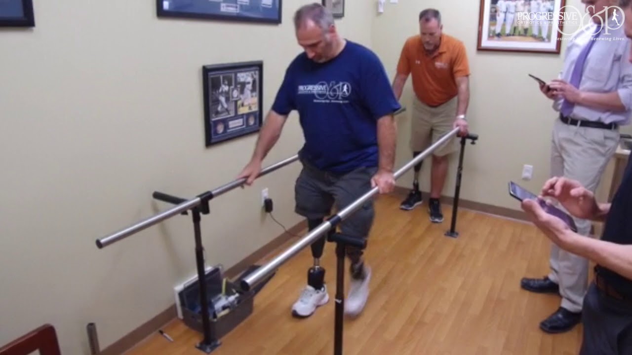 Bilateral Above Knee Amputee Walking On Ottobock X-3 & IWalk BIOM Ankle ...