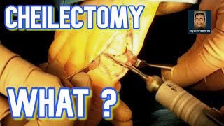 Cheilectomy Foot Surgery *GRAPHIC*. Surgery for Hallux Rigidus and Great Toe Joint Bone Spurs