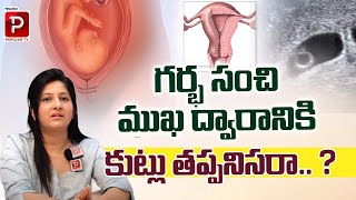 Dr Shruti Patil About Stitches To Gestational Sac | Ragavi Hospitals | Health Tips | Popular TV