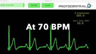 ProtoCentral HeartyPatch initial testing