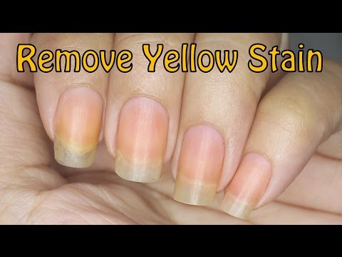 How to Remove Yellow Stain on Nails! How to Remove Yellow Stain on Nails!