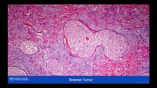 Cases with Dr Keeney: Case #2