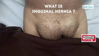 WHAT IS INGUINAL HERNIA & MEANING IN HINDI ?