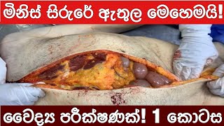 මිනිස් සිරුරේ ඇතුල මෙහෙමයි! වෛද්‍ය පරීක්ෂණයක්!(1 කොටස) human postmortem!