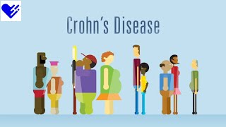 6 Food Facts for Crohn's Disease | Healthgrades