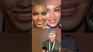 Beyoncé Before & After Plastic Surgery 👑🐝