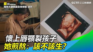 懷上唇顎裂孩子　她煎熬「該不該生下你？」最後決定催淚｜三立新聞網 SETN.com