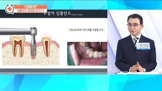 한국경제TV 건강매거진_내 치아·잇몸에 꼭 맞는 임플란트는?