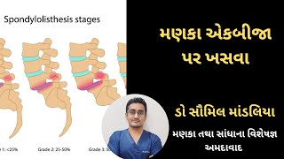 મણકા એકબીજા પર ખસવા #backpain #lysis #listhesis #spondylolisthesis