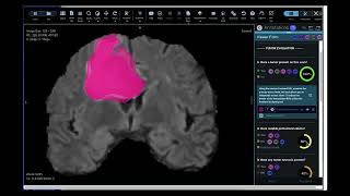 Flywheel for Oncology | Medical Imaging Platform for Data Management