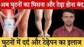 घुटने में दर्द और टेढ़ापन का इलाज बिना सर्जरी | Knee Pain Exercises | Bow LegCorrection Exercises