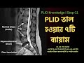 PLID 11 | PLID ভাল হওয়ার ৭টি ব্যায়াম  | 7 PLID Exercises | Doctor Shah Alam