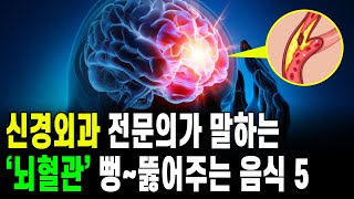 신경외과 전문의가 말하는 '뇌혈관' 뻥~ 뚫어주는 음식 5가지