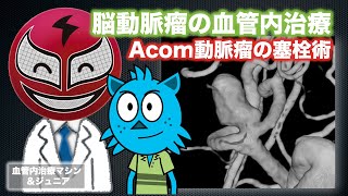 【脳動脈瘤の血管内治療】Acom動脈瘤のコイル塞栓術