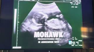 Mohawk Productions/Warner Bros. Television (1997) #22