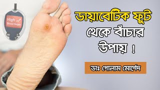 ডায়াবেটিস রোগীর পায়ের সমস্যা || Dr. Golam Morshed FCPS, MRCP (UK). Medicine \u0026 Heart Specialist