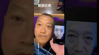 Fotona眼部抗衰大师，主要是打造：眼部灵动年轻态的，可以改善干纹，细纹，眼角纹，鱼尾纹还能做面部抗衰，改善法令纹，抬头纹，川字纹，颈纹… 舒服，安全‏‏‎‌ ⁠‌，不开刀，不动针，不破皮，无尴尬期