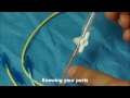 Pulmonary Artery (Swan Ganz) Catheter