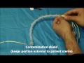 Pulmonary Artery (Swan Ganz) Catheter