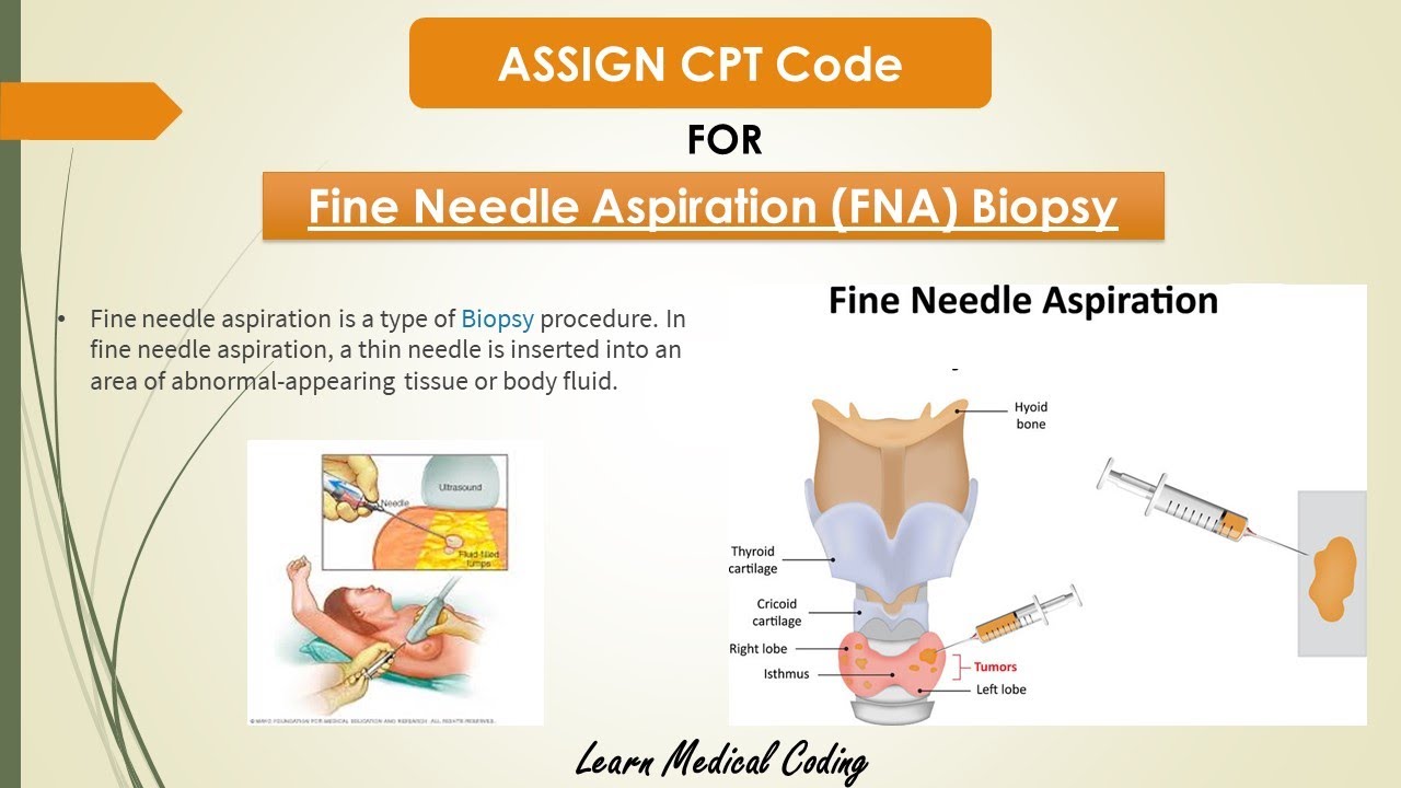 Fine Needle Aspiration CPT Code 2020 | Fine Needle Biopsy CPT Code ...