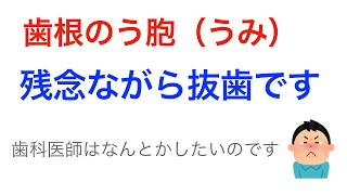 【閲覧注意】知らないと後悔する「歯の」の恐怖　番外編　 歯根のう胞＋歯周病　抜歯なんです…。