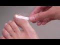 How to use Schollmed Once Weekly* Fungal Nail Treatment