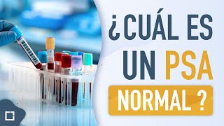 Próstata inflamada o grande ¿cual es un PSA NORMAL?