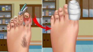 The Monster in the foot || ASMR removel the Lage hair ||  foot care animation