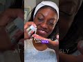 Get SkinMedica TNS Serum at Skinmedix: Youthful Skin in Just 2 Weeks! | Captions