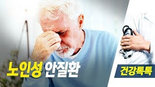 갈수록 눈이 침침, 노인성 안질환 - 2018 1001 건강톡톡 아침이 좋다