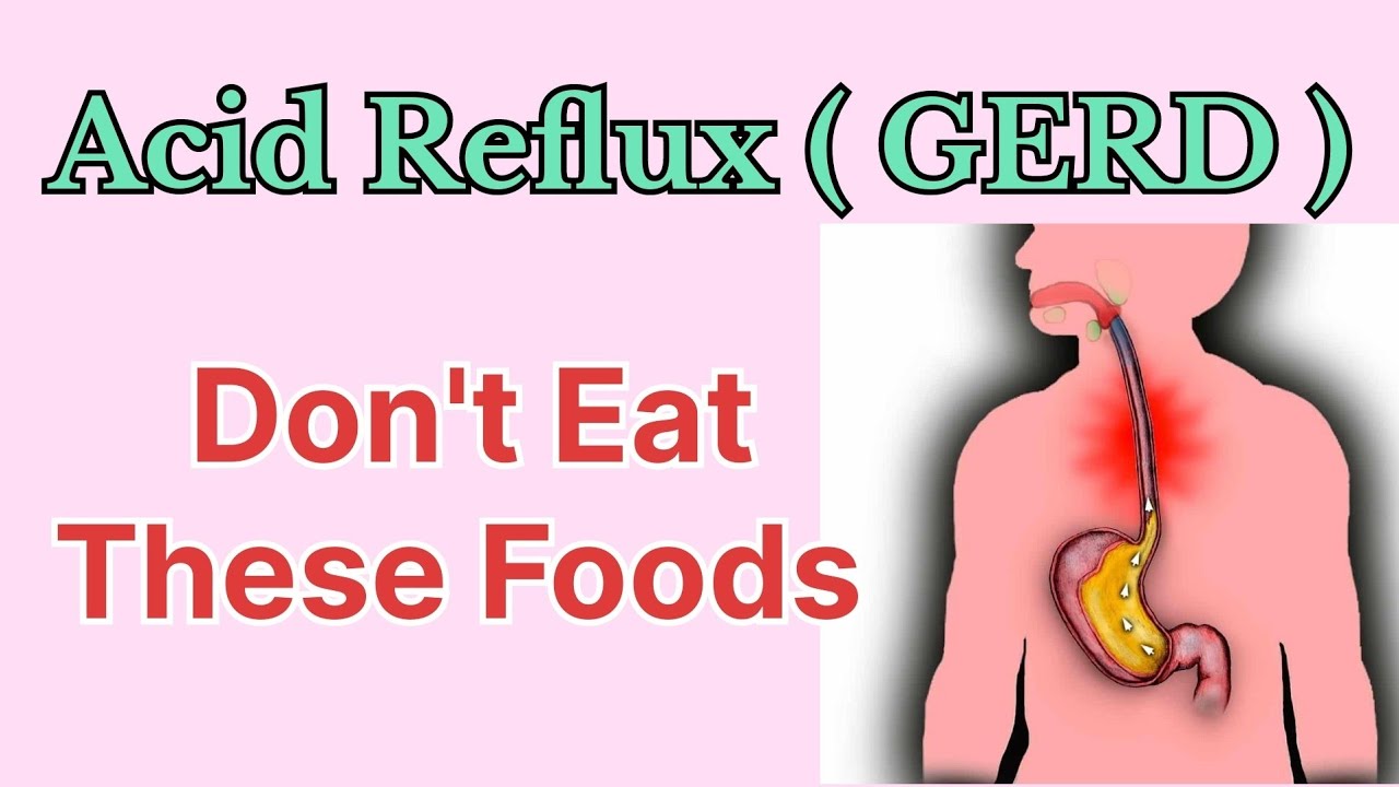 Acid Reflux (GERD, Gastroesophageal Reflux Disease) - How To Reduce ...