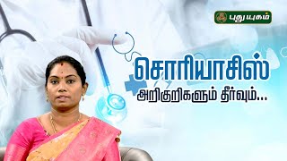 சொரியாசிஸ் அறிகுறிகளும் தீர்வும்... | Psoriasis | Dr.Saranya #doctoroncall #Puthuyugamtv