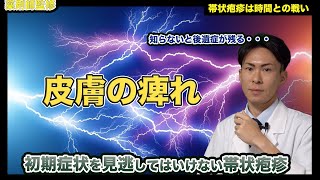 帯状疱疹になってしまう前に見てほしい動画。初期状態で薬物治療ができれば完治します。【帯状疱疹になったことのある薬剤師が解説】