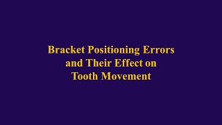 Bracket Positioning Errors and Their Effect on Tooth Movement