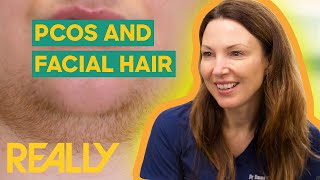 Dr. Emma Helps Patient With PCOS and Facial Hair | The Bad Skin Clinic