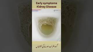 Only 3 early symptoms of kidney disease!  #ck #ckd #kidneyhealth #urine