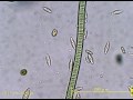 緑藻と戯れる珪藻たちdiatoms seem to play with green algae