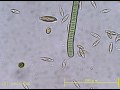 緑藻と戯れる珪藻たちdiatoms seem to play with green algae