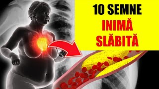 ALERTĂ! 10 SEMNE DE AVERTIZARE CĂ INIMA TA SLĂBEȘTE (RISC DE INSUFICIENȚĂ CARDIACĂ)