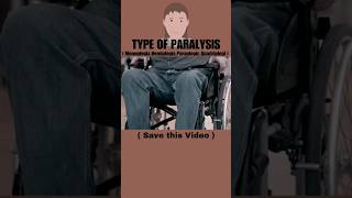 Types of paralysis 🧑‍🦼🚶#shorts #neuroscience #facts #educationalvideo