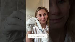 Microneedling at home Step by Step