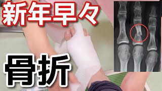 骨折しました…怪我直後から2日目までの様子