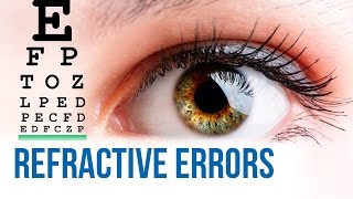 Refractive errors of the eyes