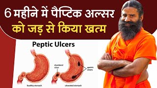 6 महीने में पैप्टिक अल्सर (Peptic Ulcer) को जड़ से किया खत्म || Swami Ramdev