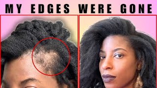 How I GREW BACK my DAMAGED EDGES! 2 MAJOR ANNOUNCEMENTS.