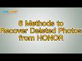 How to Recover Deleted Photos from HONOR? [6 Methods]